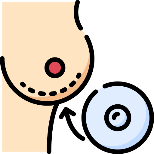 Breast implant